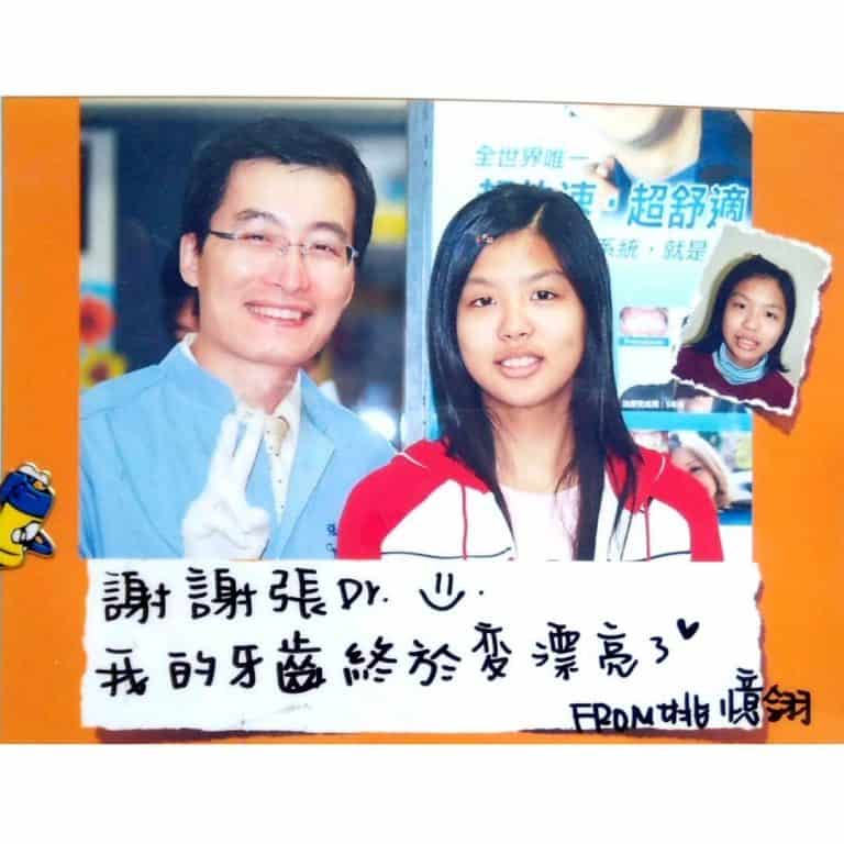 瑞比案例分享見證 隱適美矯正中心