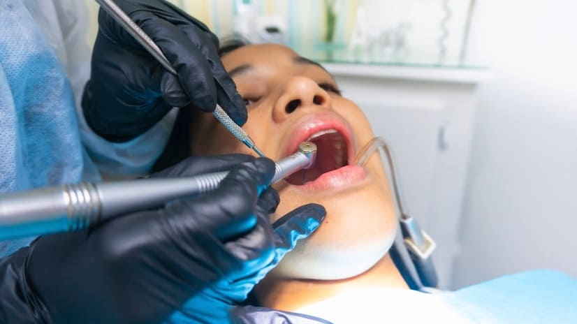 定期洗牙、檢查牙齒，能有效預防牙周病。（圖片來源：Unsplash）