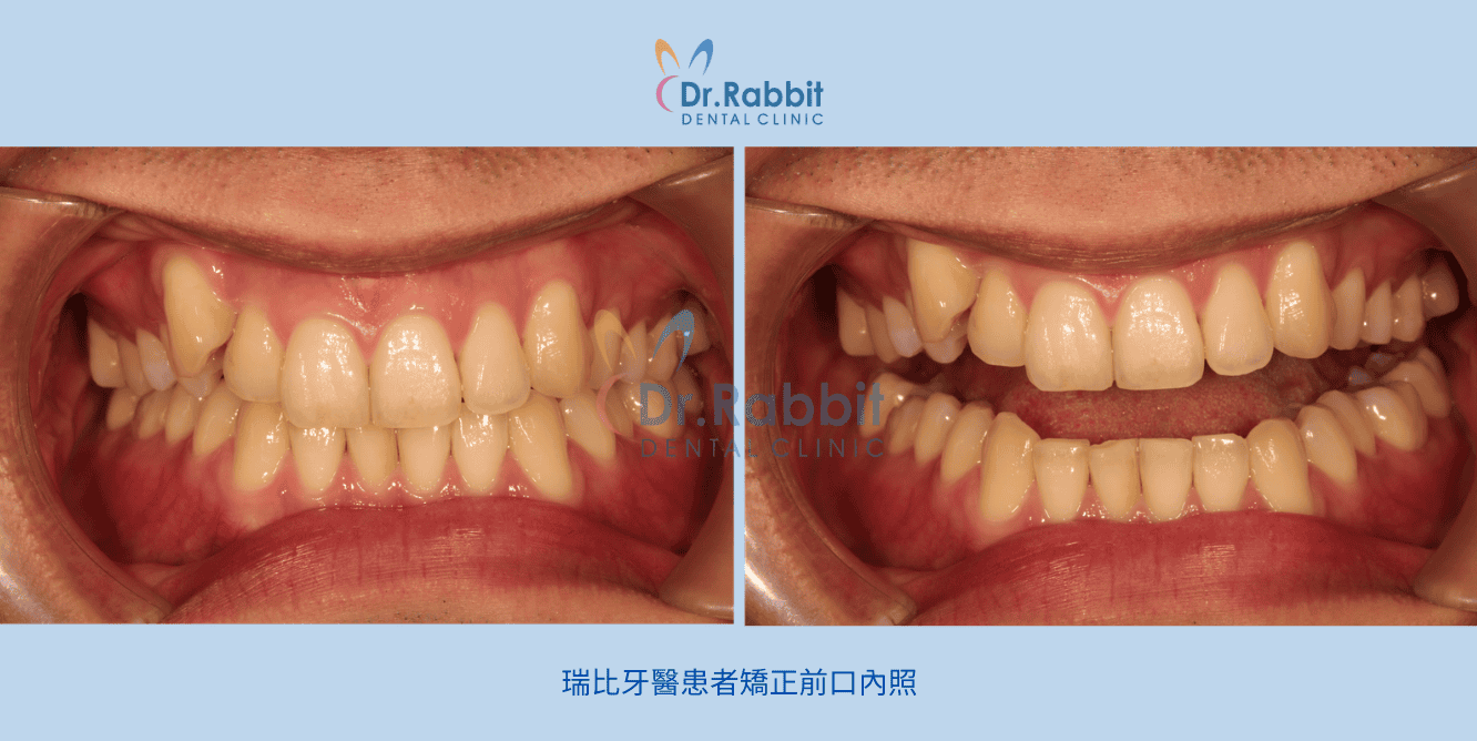 截圖 2026-03-02 下午4.31.38