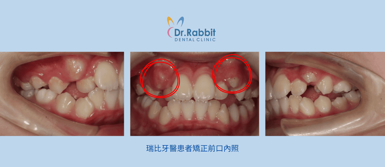 截圖 2026-03-02 下午4.32.14