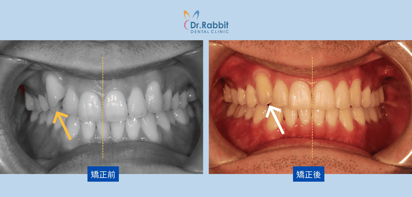 截圖 2026-03-02 下午4.41.19