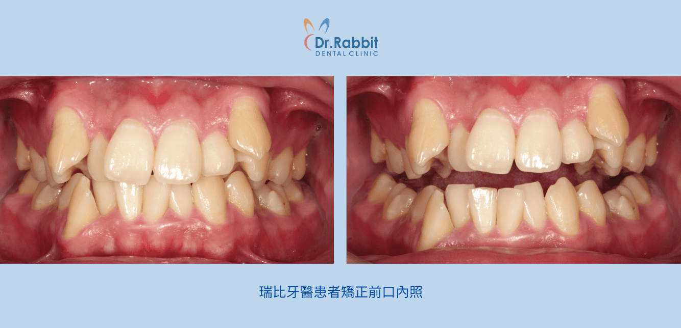 截圖 2026-03-02 下午4.44.17