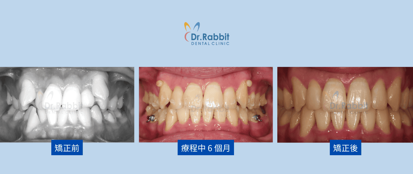截圖 2026-03-02 下午4.45.24